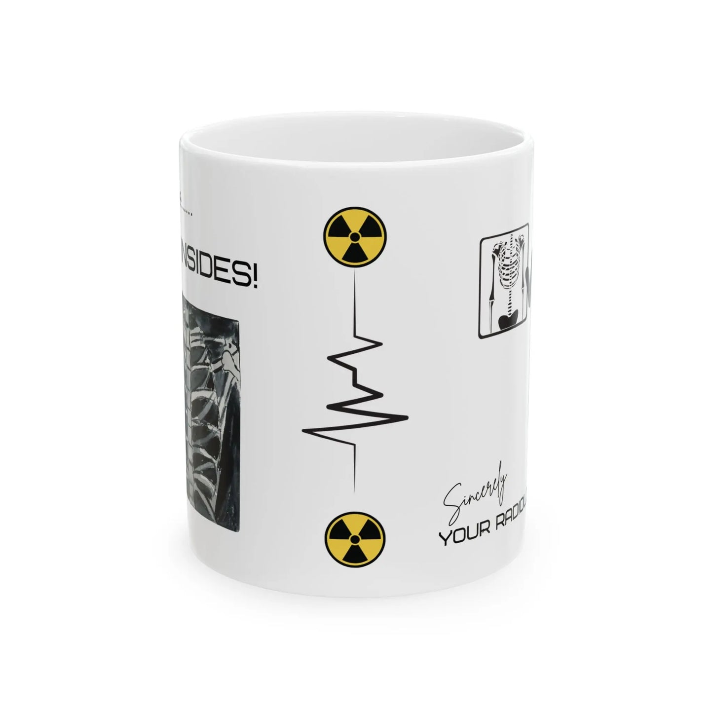 White mug with radiology-themed design featuring yellow and black radiation symbols on a white background