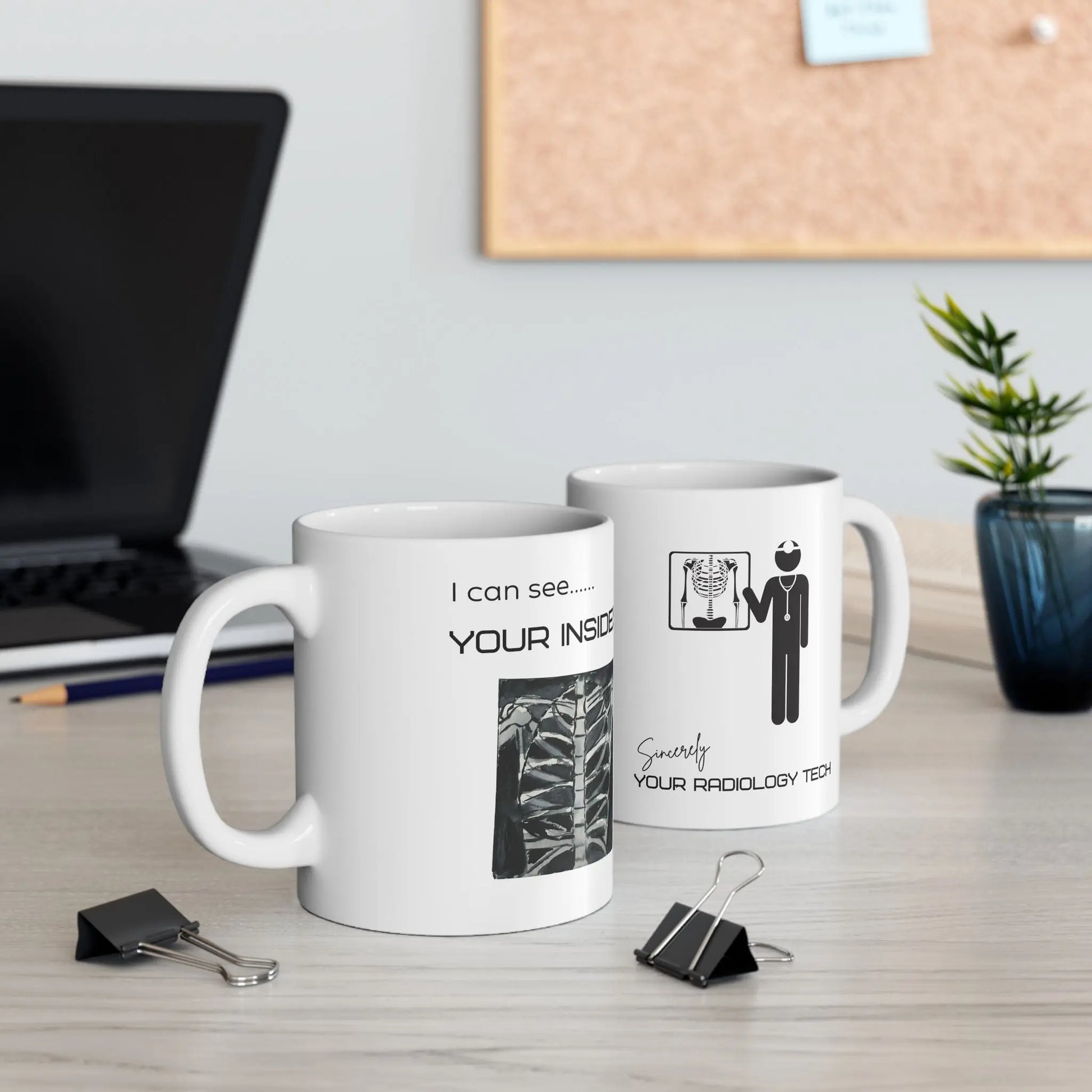 Two mugs with humorous radiology designs on a desk with office items.